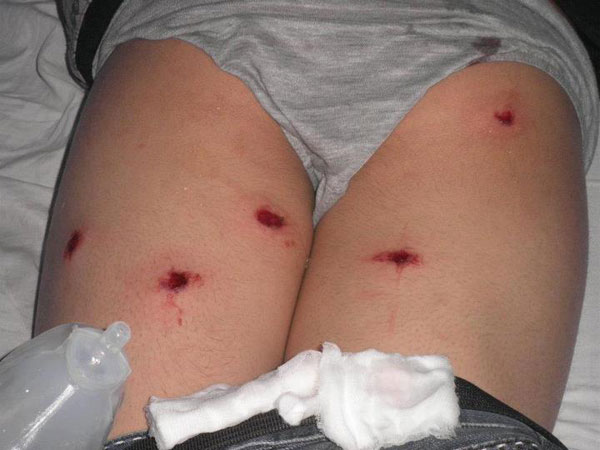 La imagen muestra a uno de los menores heridos el lunes, frente al hospital de Collipulli.